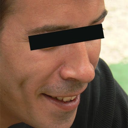 Nicolas