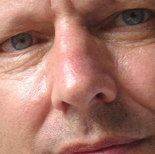 Philippe