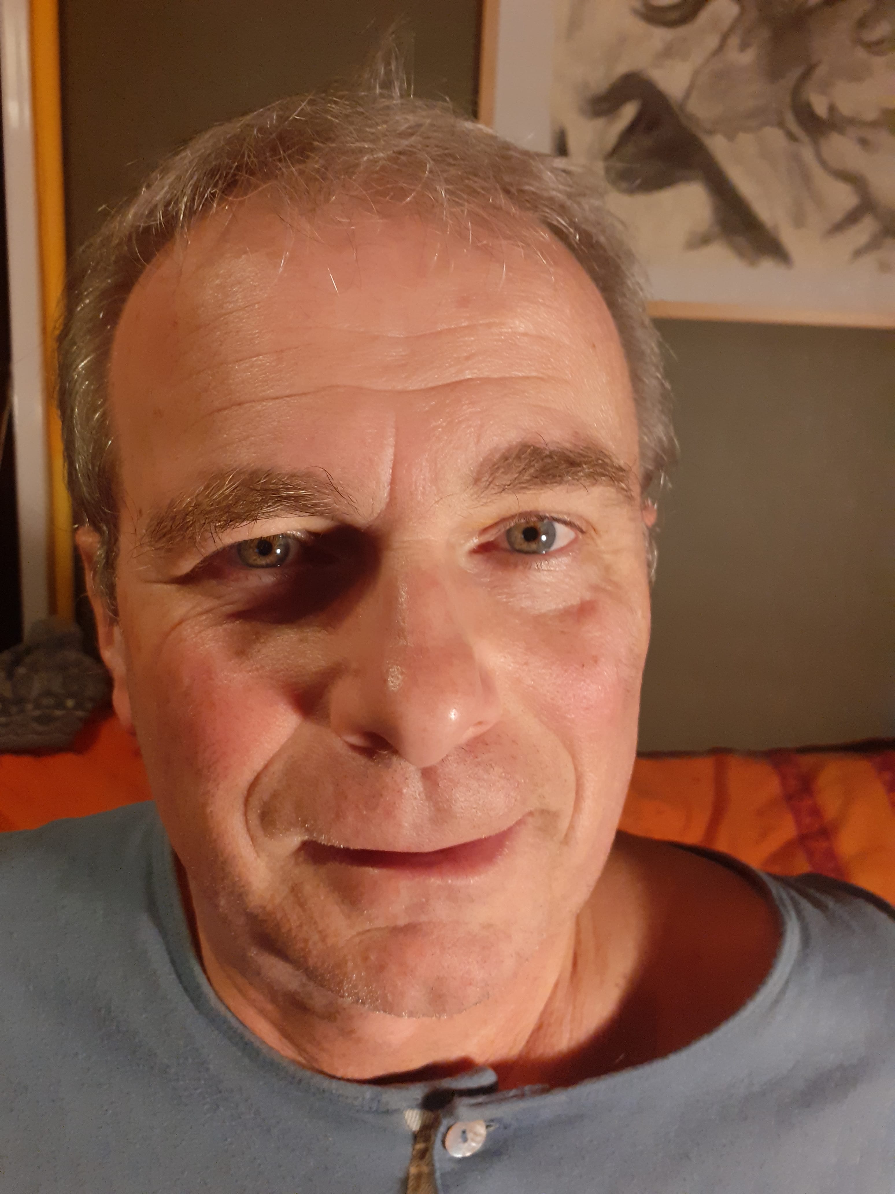 Philippe